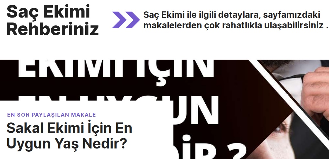 Saç Ekimi Fiyatları Ne Kadar?