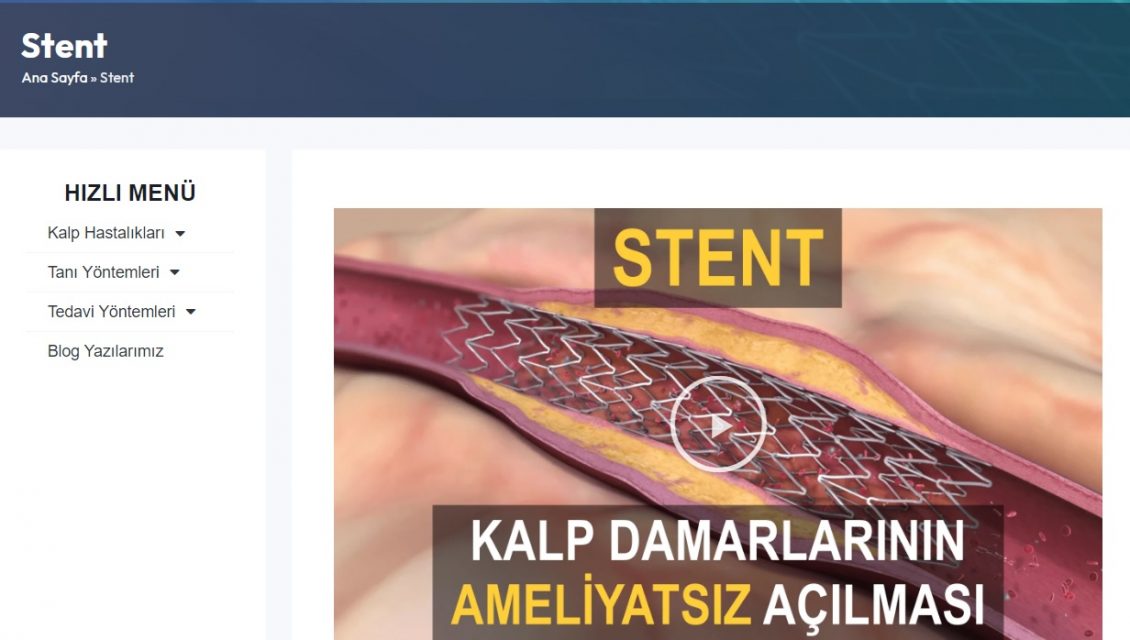 Stent: Kalp Sağlığında Önemli Bir Müdahale Aracı